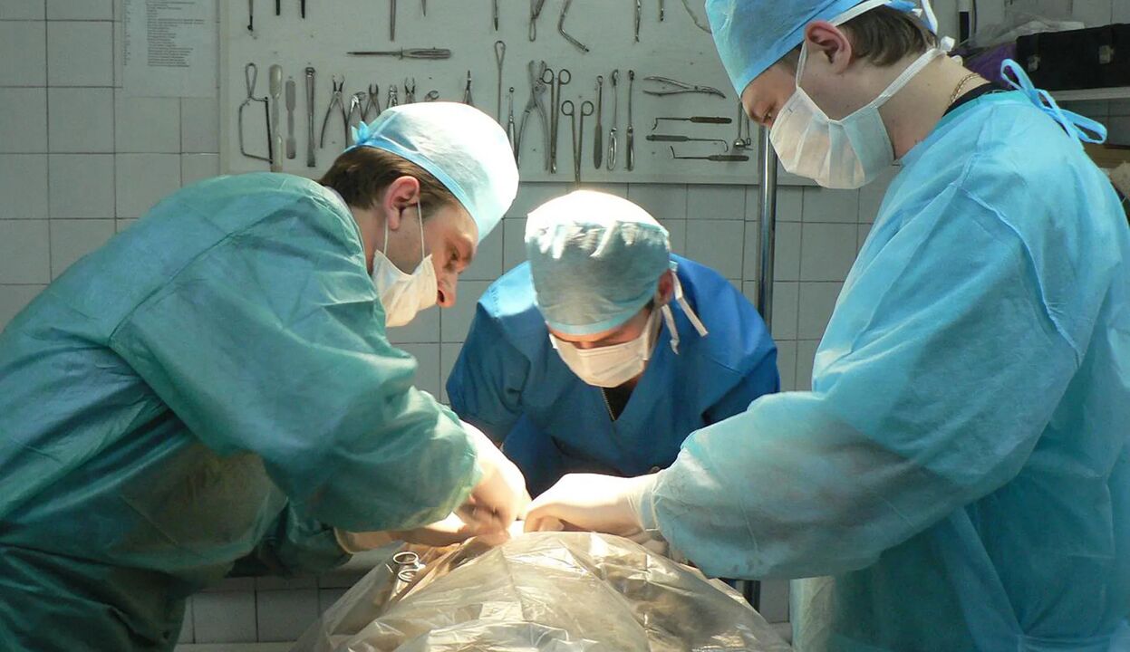 Pembedahan adalah cara yang mahal untuk membesarkan zakar