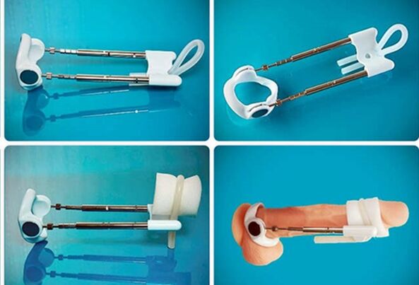 extender untuk penebalan zakar